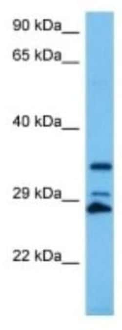 TAS2R103 Rabbit anti-Mouse, Polyclonal, Novus Biologicals 100 &mu;g | Buy Online | Novus Biologicals | Fisher Scientific